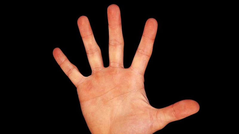 Beş parmağın beşi bir olmaz